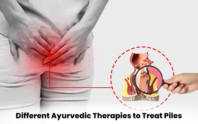 Different Ayurvedic Therapies to Treat Piles